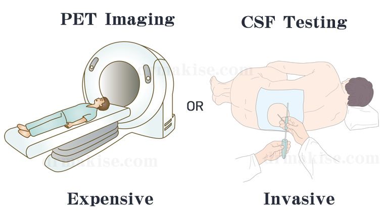 diagnosis alzheimer disease