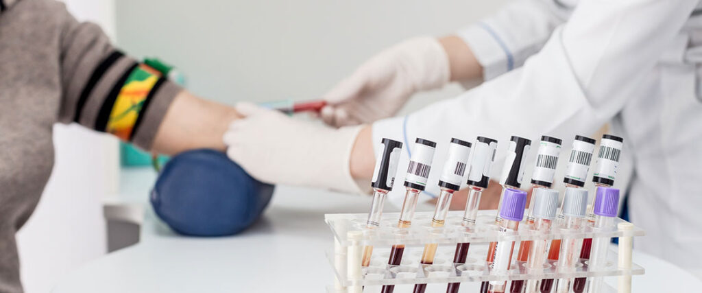 blood test to early prediction of Alzheimer's progression